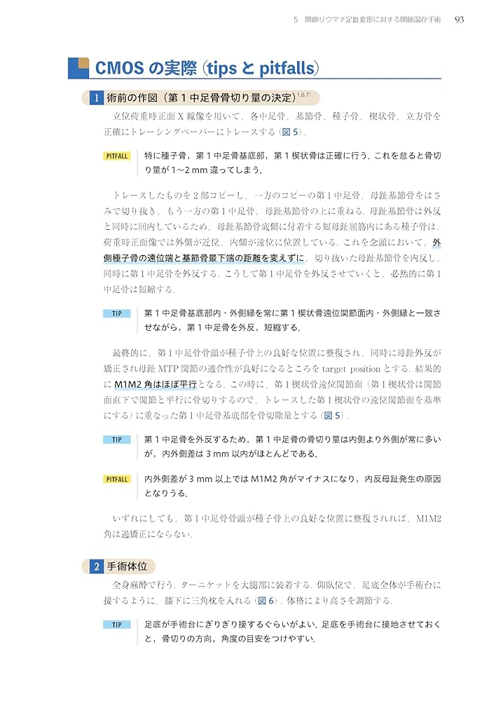 Amazon.co.jp: 誰も教えてくれなかった足の外科[Web動画付
